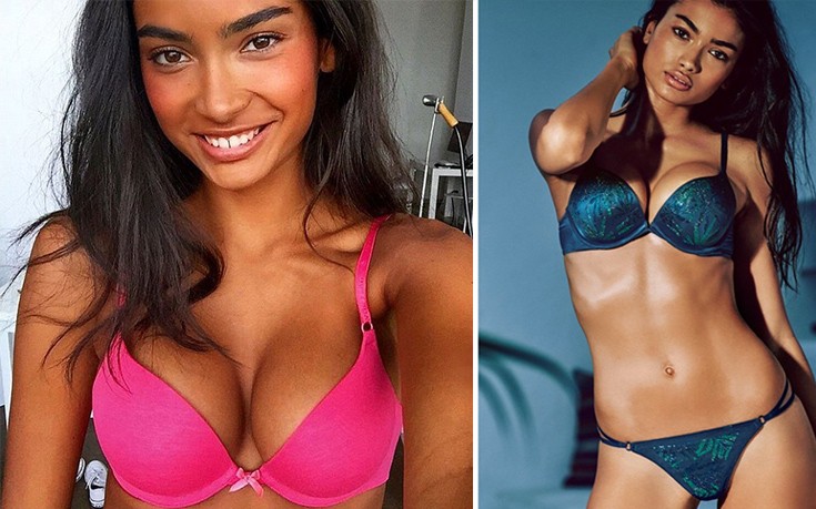 Η ιστορία της Kelly Gale που έγινε μοντέλο… τυχαία