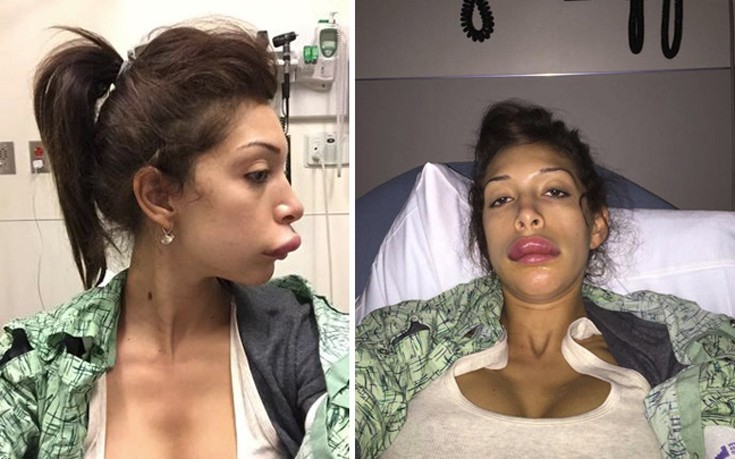 plastikes7 plastikes7