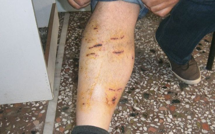Αγέλη σκυλιών επιτέθηκε σε αγρότες στον Τύρναβο