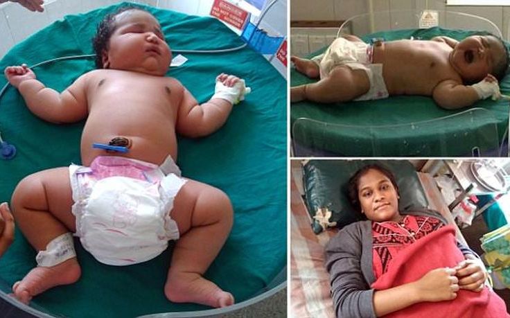 Γεννήθηκε μωρό &#8211; «γίγαντας» στην Ινδία