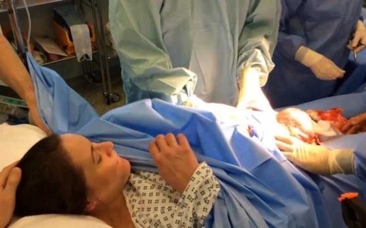 Το viral βίντεο μητέρας που γέννησε με «φυσιολογική καισαρική»