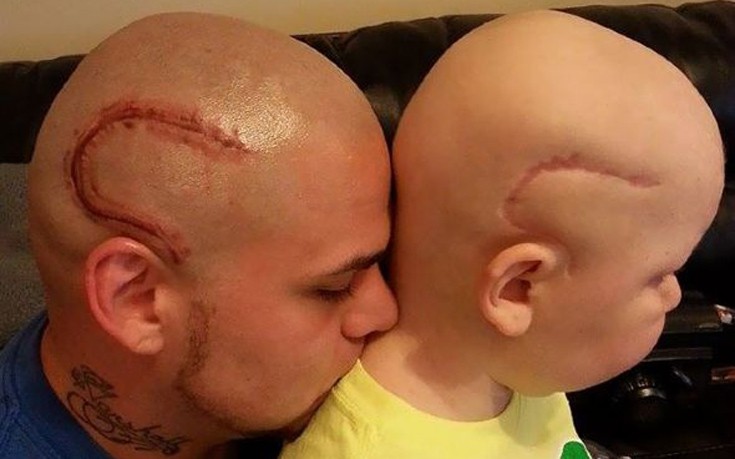 Συγκλονιστικός μπαμπάς έκανε τατουάζ το σημάδι του παιδιού του