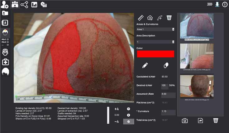 trixoskopisi3 trixoskopisi3