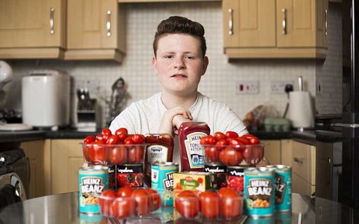 Έφηβος εθισμένος στη ντομάτα υπνωτίστηκε για να φάει άλλο φαγητό