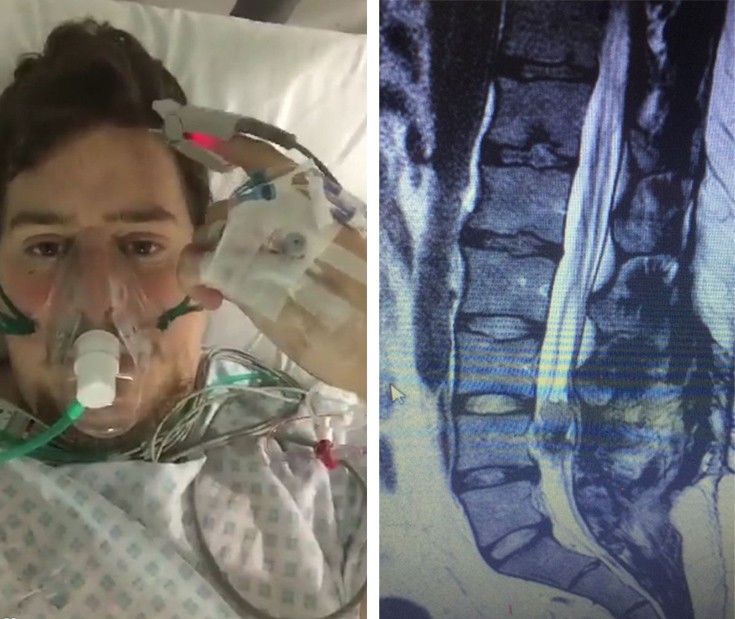 minigitida2 minigitida2