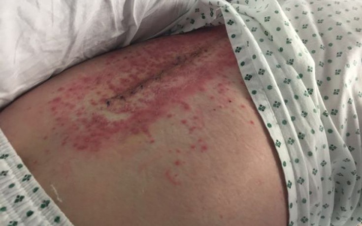 minigitida4 minigitida4