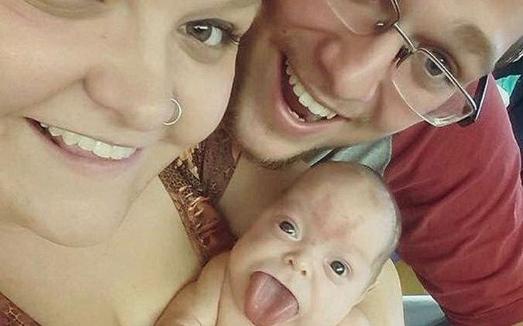 Το μωράκι που γεννήθηκε με γλώσσα ενηλίκου χαμογελά για πρώτη φορά μετά την επέμβαση