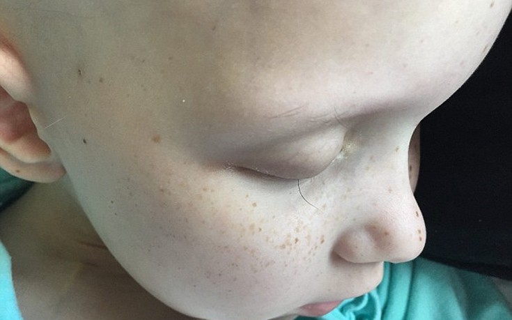 Η 7χρονη Hayley κλείνει τα μάτια και κάνει μια ευχή: να ζήσει