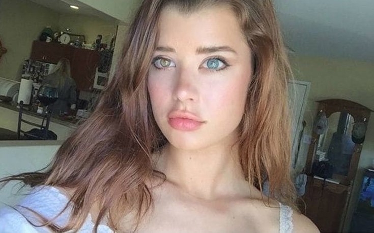 Η ιδιαίτερη ομορφιά ανθρώπων και ζώων με ετεροχρωμία