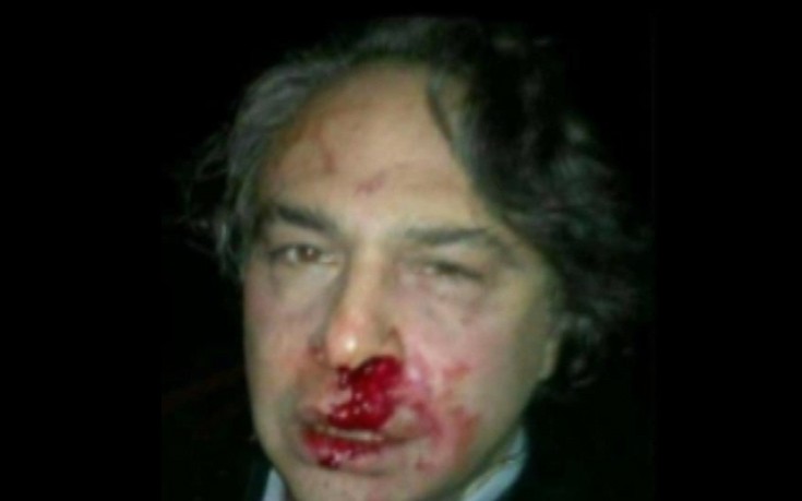 Τούρκοι παρακρατικοί ξυλοκόπησαν άγρια σχεδιαστή
