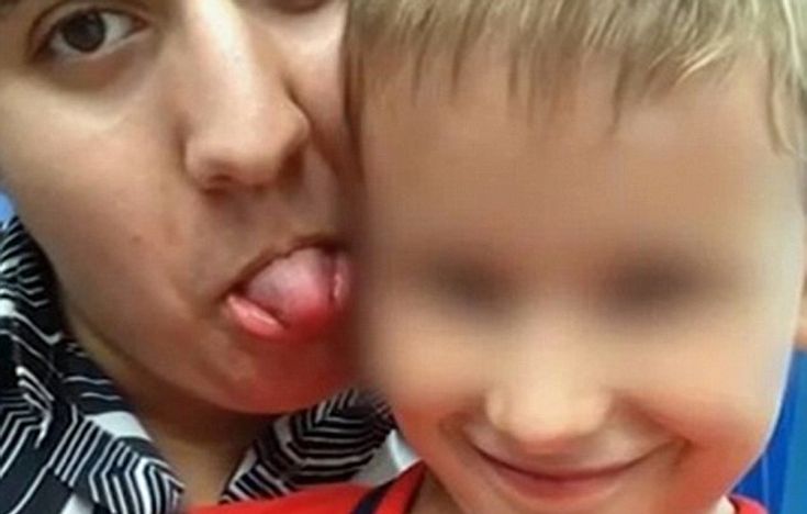 Το τρικ με τη φωτιά στοίχισε τη ζωή 12χρονου αγοριού στη Ρωσία