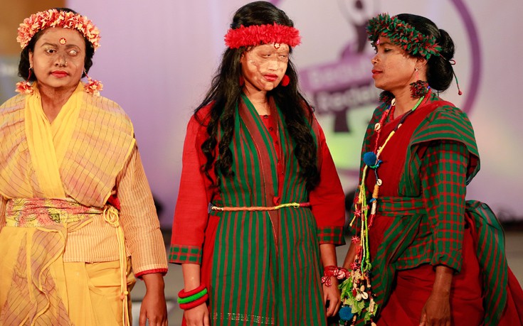 BANGLADESH_ACIDSURVIVORS13