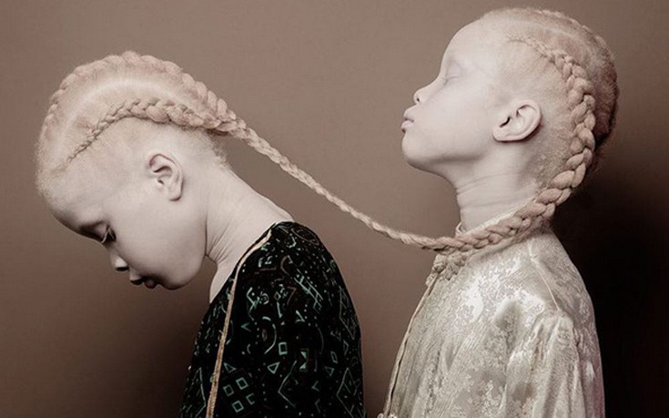 Δίδυμες με αλφισμό κατακτούν το χώρο της μόδας