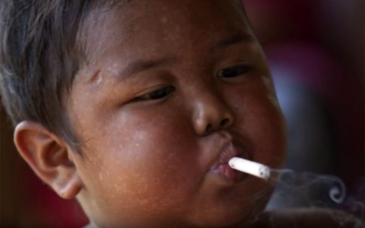 Η νέα ζωή του δίχρονου παιδιού που κάπνιζε 40 τσιγάρα τη μέρα