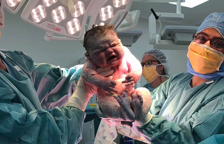 Το μωρό που ήρθε στον κόσμο και ζυγίζει ήδη 6 κιλά