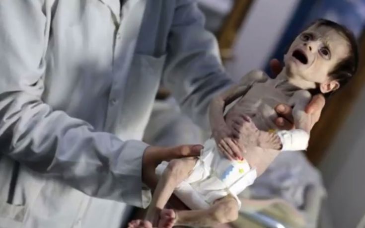 Η πιο σκληρή αποτύπωση του φρικτού προσώπου του πολέμου στη Συρία