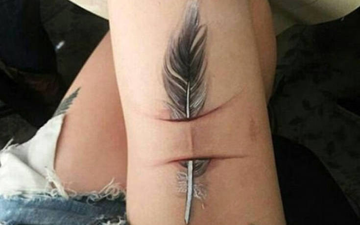 Μετέτρεψαν τα σημάδια στο σώμα τους σε έργα τέχνης