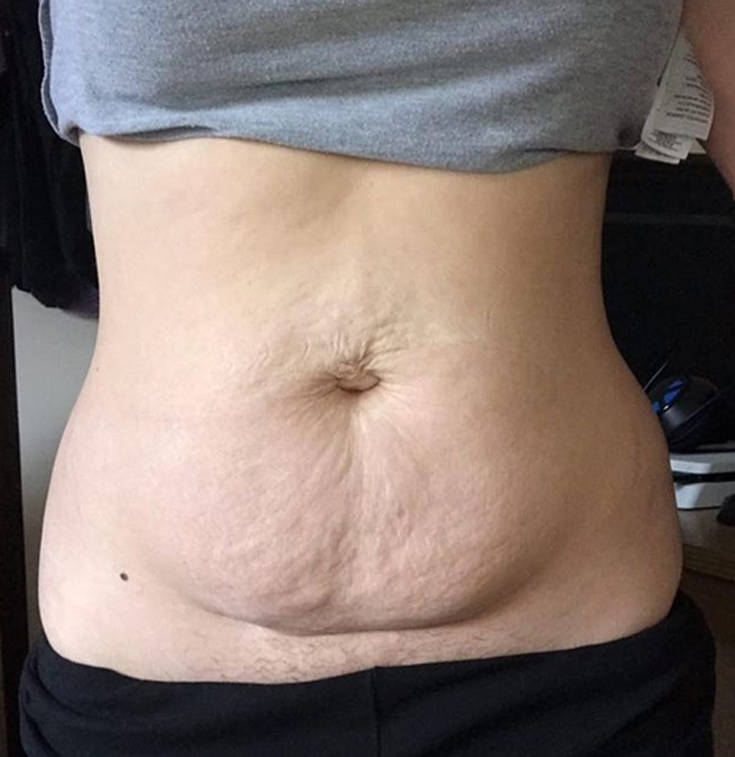 takebackpostpartum2 takebackpostpartum2