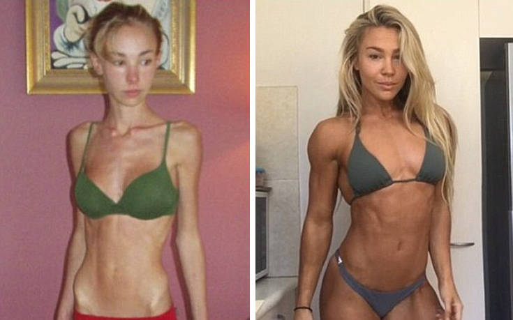 Ζύγιζε 26 κιλά και σήμερα είναι fitness model