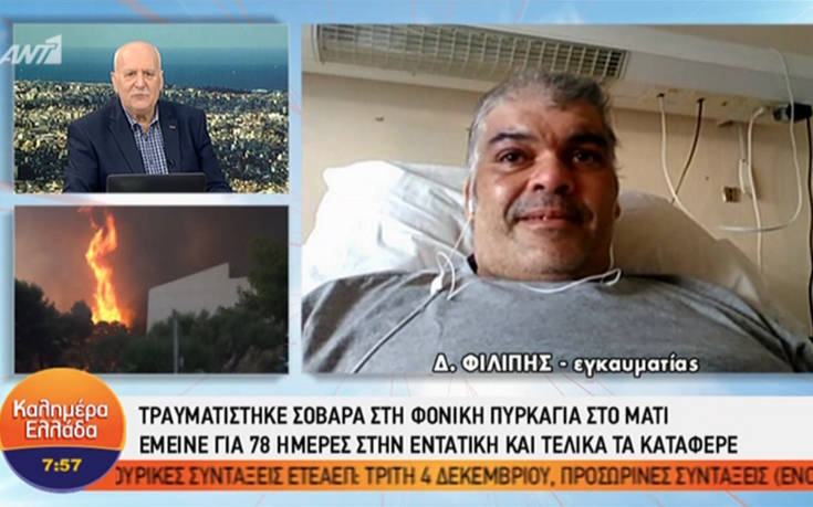 Από τη φονική φωτιά στο Μάτι στην εντατική για 78 μέρες και στο τέλος νικητής