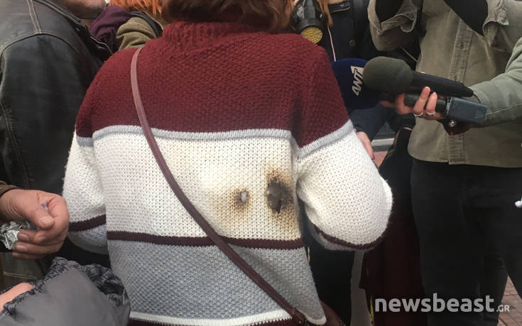 Κρότου λάμψης έκαψε τη μπλούζα διαδηλώτριας, υπέστη έγκαυμα