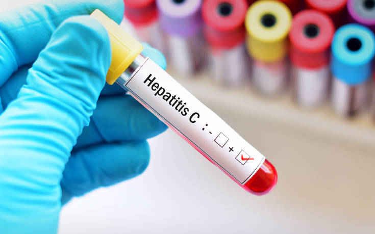 Ηπατίτιδα C: Ενθαρρυντική η αύξηση που παρουσιάζουν οι εξετάσεις για τη νόσο