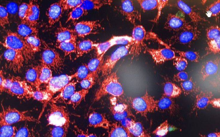 Αισιόδοξες εξελίξεις για τους καρκινοπαθείς από τις νέες θεραπείες με ραδιενεργά ισότοπα