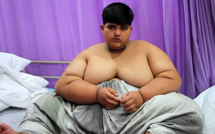 Το πιο παχύσαρκο παιδί του κόσμου είναι 10 χρονών και ζυγίζει 196 κιλά