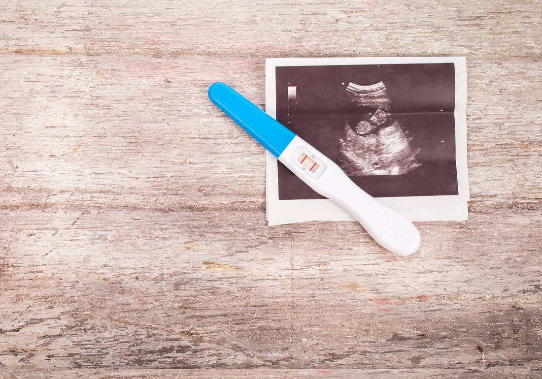 shutterstock385314055 | Lamianow.gr