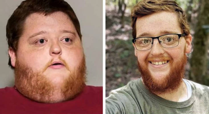 Πρόσωπα πριν και μετά τη μεγάλη απώλεια κιλών