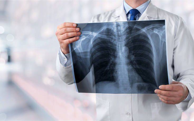 ΗΠΑ: Στους 37 οι θάνατοι από τη μυστηριώδη πνευμονική ασθένεια που συνδέεται με το άτμισμα