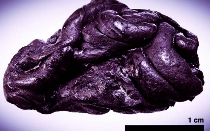 Επιστήμονες ανακάλυψαν ανθρώπινο DNA πάνω σε μια… τσίχλα 5.700 ετών