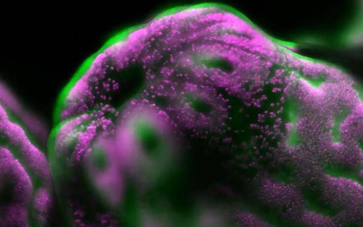 Δείτε εκπληκτικά βίντεο του μικρόκοσμου από τον διαγωνισμό της Nikon