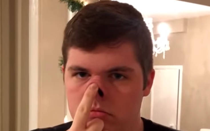 Ο τύπος με τη μύτη&#8230; λάστιχο