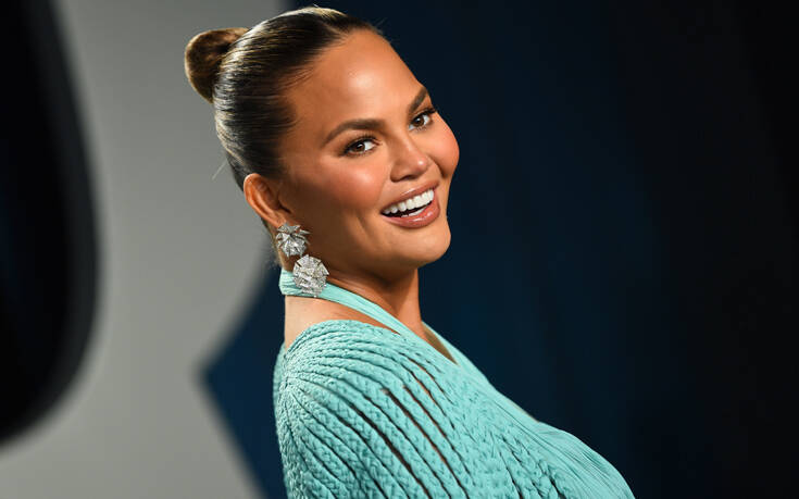 Η Chrissy Teigen μιλά ανοιχτά για την πλαστική επέμβαση που έκανε στα 20 της