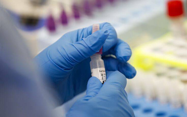 Κορονοϊός: Αυστραλοί επιστήμονες υποστηρίζουν πως βρήκαν φάρμακο