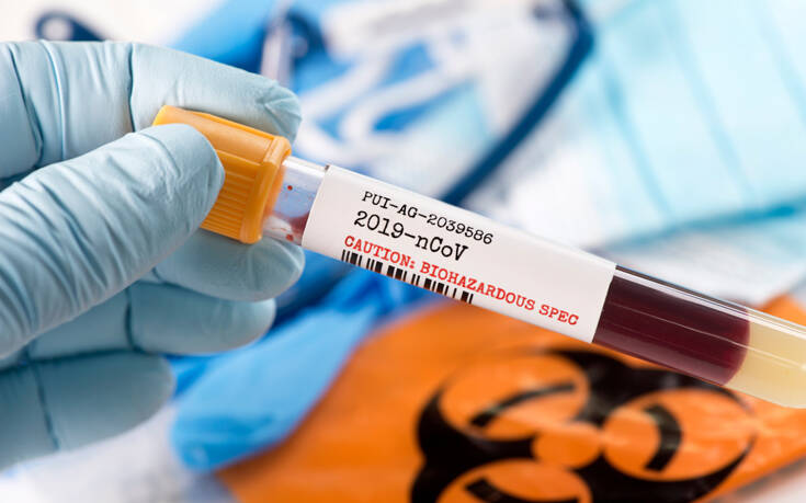 Κορονοϊός: Νέα τεστ αίματος θα δείχνουν την εξάπλωση του ιού