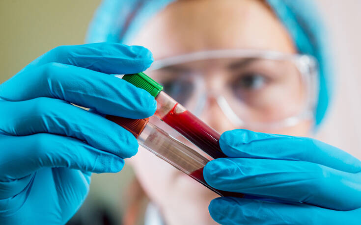 Τεστ αίματος ανιχνεύει με τη βοήθεια της τεχνητής νοημοσύνης πάνω από 50 είδη καρκίνου