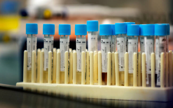 Ιαπωνία: Ασαφή τα αποτελέσματα δοκιμής του φαρμάκου Avigan κατά του κορονοϊού
