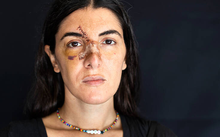 Анжелика Сабаунджян, которая была ранена в своем офисе в августе Associated Press, лучшие фотографии недели