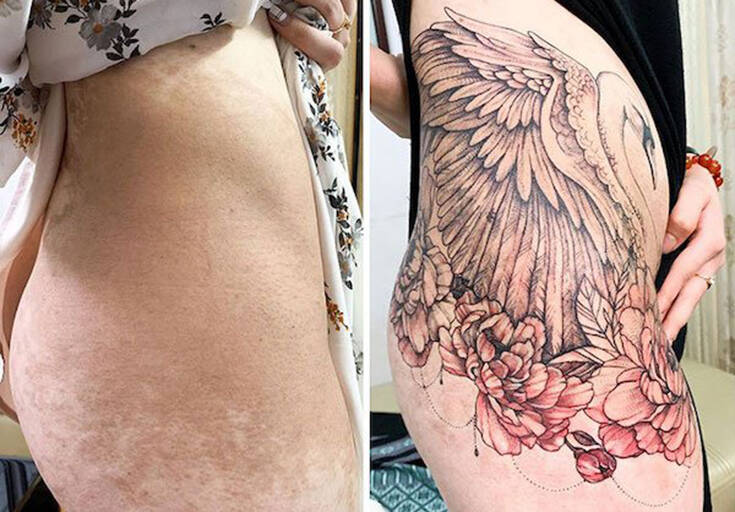 Σημάδια στο σώμα που έγιναν εντυπωσιακά τατουάζ