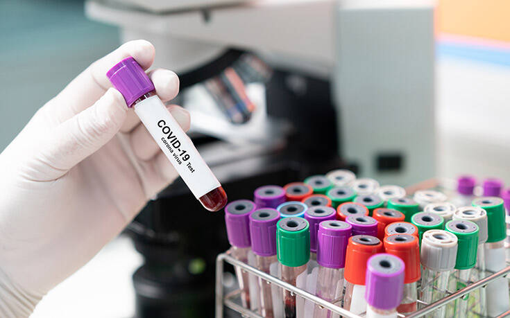 ΗΠΑ: «Πράσινο φως» για διαγνωστικό τεστ που ξεχωρίζει τον κορονοϊό από γρίπη