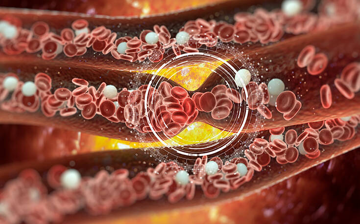 Ο μεγάλος κίνδυνος ασθενών κορονοϊού για εν δυνάμει θανατηφόρους θρόμβους αίματος