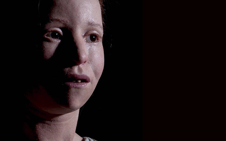 «Το κορίτσι που γεννήθηκε δυο φορές»