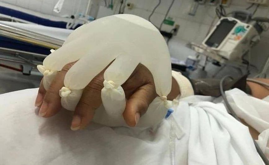 «Το χέρι του Θεού»: Τα γάντια με ζεστό νερό σε ασθενείς με κορονοϊό για να μη νιώθουν μόνοι