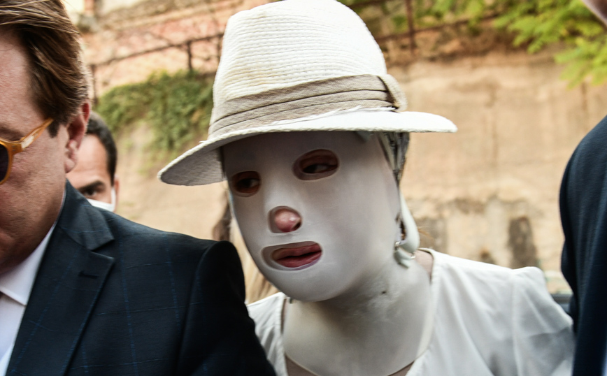 Επίθεση με βιτριόλι: Πότε η Ιωάννα θα βγάλει τη μάσκα αποκατάστασης