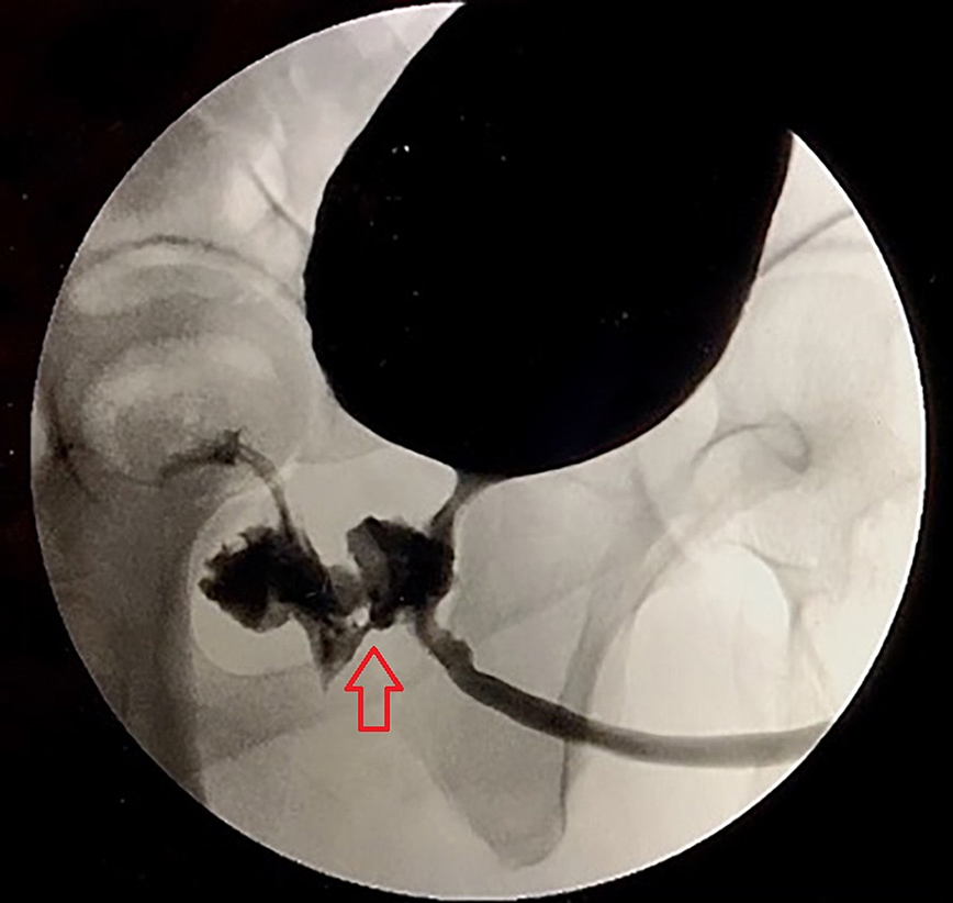 Ακτινογραφία ασθενούς Ακτινογραφία ασθενούς