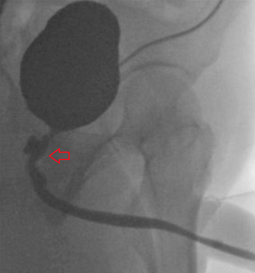 Ακτινογραφία ασθενούς Ακτινογραφία ασθενούς