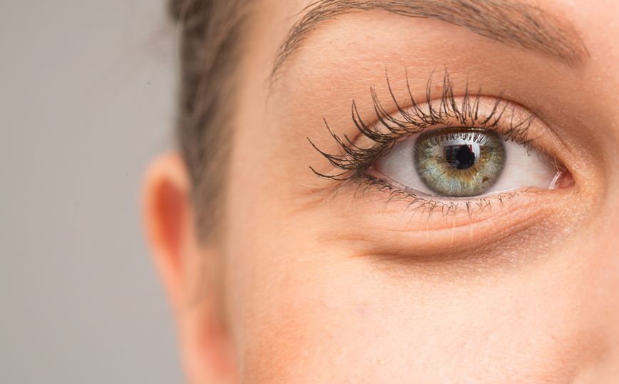 Μαύροι κύκλοι κάτω από τα μάτια Μαύροι κύκλοι κάτω από τα μάτια