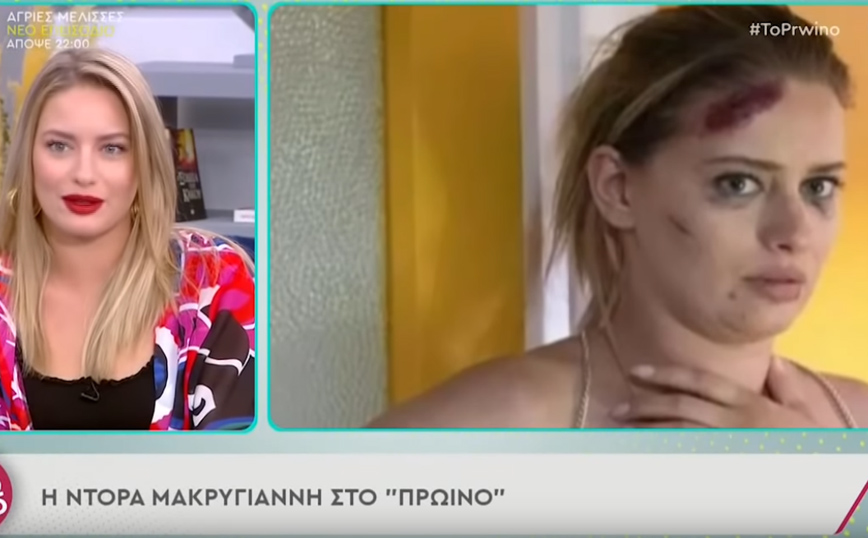 Ντόρα Μακρυγιάννη: Κάποια πράγματα νομίζω πως ήρθε η ώρα να σταματήσουν – Μου βιάζεις την προσωπική μου ζωή